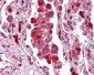 S100A9 / MRP14 Antibody (Internal)